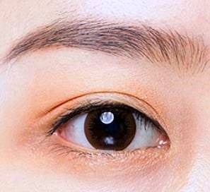 김포쌍꺼풀수술 돌출눈/함몰눈 이렇게 해야 성공합니다 관련 이미지 4