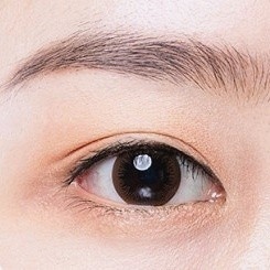 강서구눈성형 잘하는곳? 쌍수 부작용 예방 팁 관련 이미지 4
