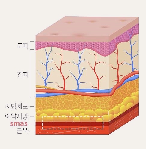 목동안면거상 흉터 줄일 수 있는 방법 1가지 관련 이미지 2