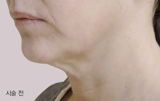 목동인모드 효과 이것 2가지 모르면 돈만 낭비합니다 관련 이미지 5