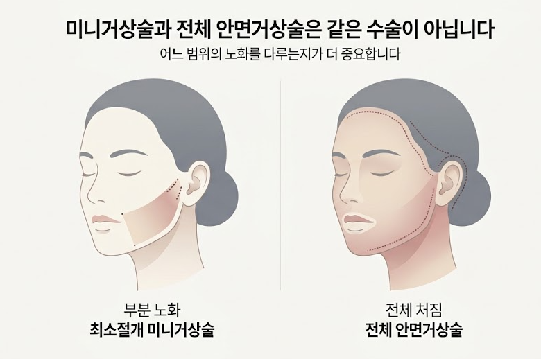 Mok-dong Facelift Surgery: Is It Always Better to Do It Later? image 4