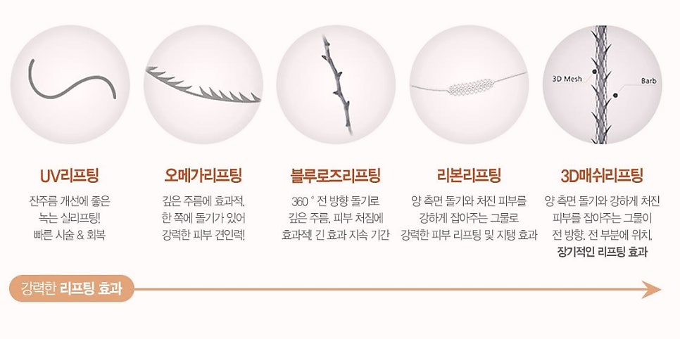 목동리프팅 성형외과 전문의가 추천하는 솔루션 3가지 관련 이미지 3