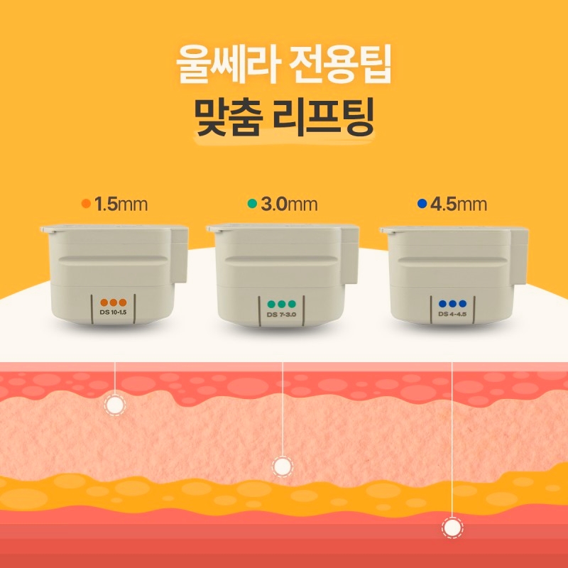 목동울쎄라 송지효 레이저 리프팅 무조건 600샷 맞아야 하나요? 관련 이미지 3