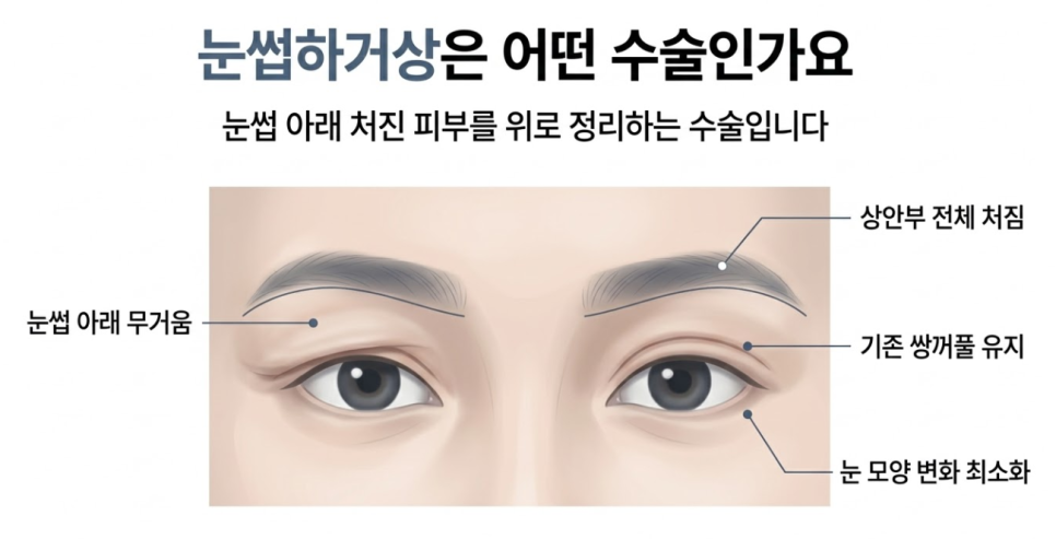 Why Eyebrow Lift Surgery in Mok-dong, Yangcheon-gu Is Often Confused with Upper Blepharoplasty image 4