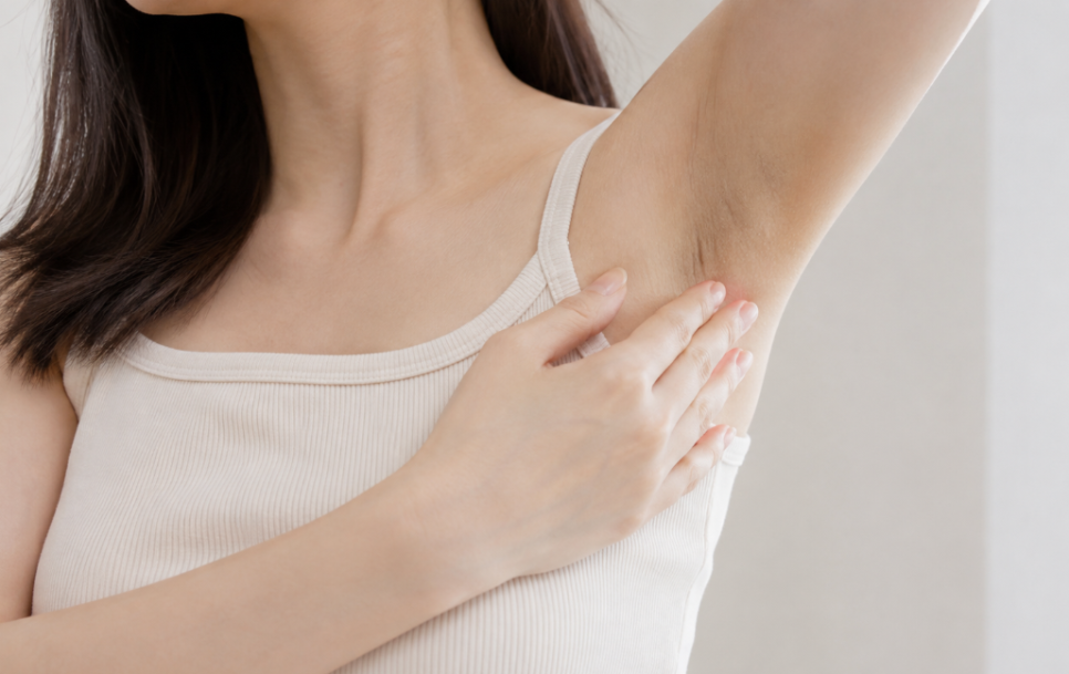 Did You Think It Was Sunburn? It May Be Hyperpigmentation: What to Check Before Summer Body Pigmentation Toning image 5