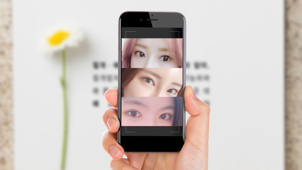 목동트로이성형외과 많은 분들의 선택을 받는 이유 2가지 관련 이미지 5