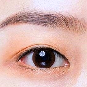 김포쌍꺼풀수술 돌출눈/함몰눈 이렇게 해야 성공합니다 관련 이미지 2