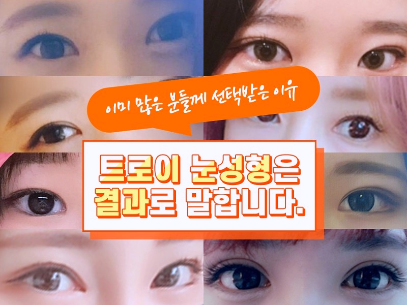 강서구 앞트임 뒤트임 중 나에게 필요한 수술은? 관련 이미지 4