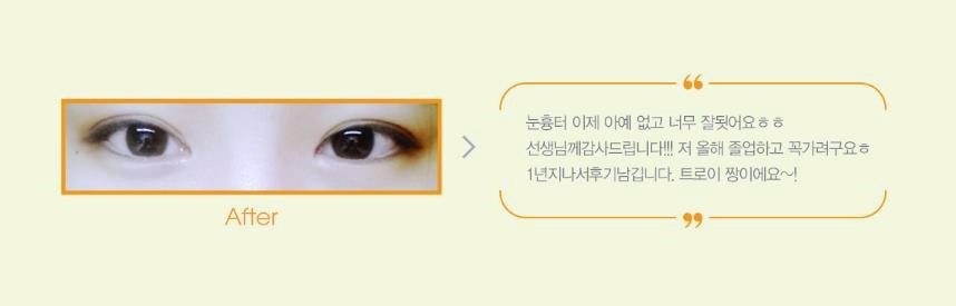 오목교성형외과 추천 많이 받는 곳 특징 3가지 관련 이미지 2