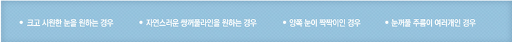 강서구성형외과 쌍수매몰 자연스러운 눈 만드는 매몰법 관련 이미지 2