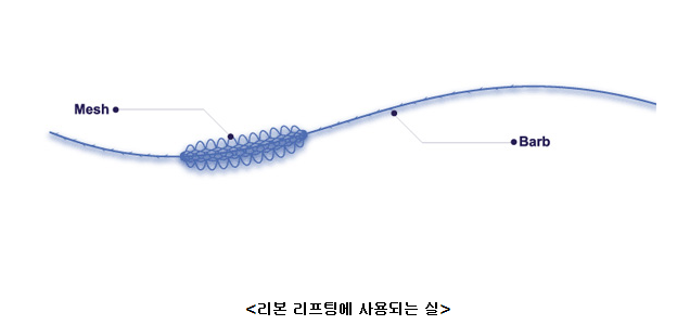 [영등포성형외과] 피부에 주는 강력한 동안 효과, 리본리프팅! 관련 이미지 1