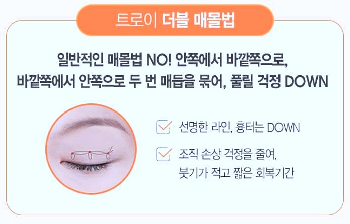목동쌍수 매몰vs절개 방학때 하기 좋은 수술방법 따로 있나요? 관련 이미지 1