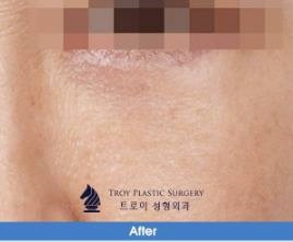 김포눈밑지방재배치 관련 이미지 3