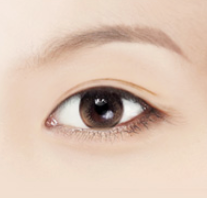 Mokdong Lower Blepharoplasty Surgery: Worried About Ectropion Side Effects? image 4