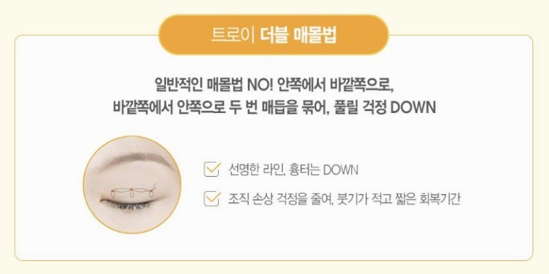 목동 쌍꺼풀수술 붓기, 매몰vs절개 어떤게 더 빨리 빠지나요? 관련 이미지 2