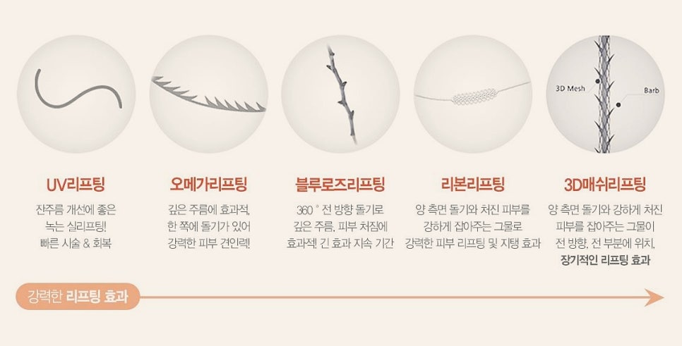 오목교실리프팅 통증이 두려우시다면 관련 이미지 2