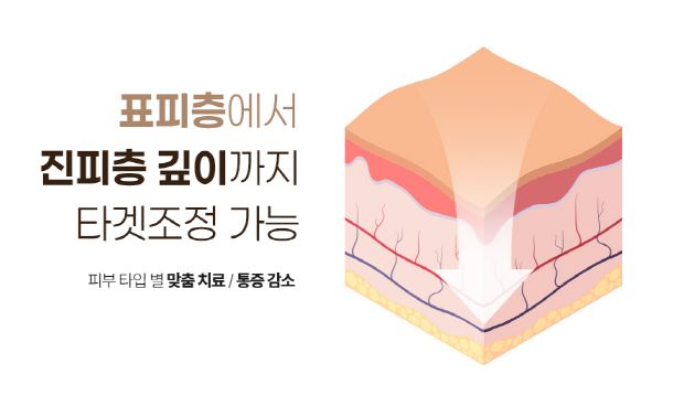 목동 기미 잡티 레이저? 관련 이미지 4