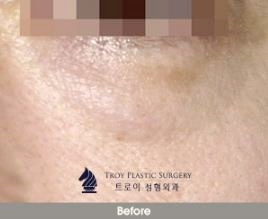 김포눈밑지방재배치 관련 이미지 2