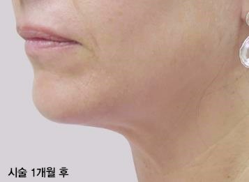 영등포인모드 잘하는 곳? ‘이것’ 꼭 확인하세요 관련 이미지 6