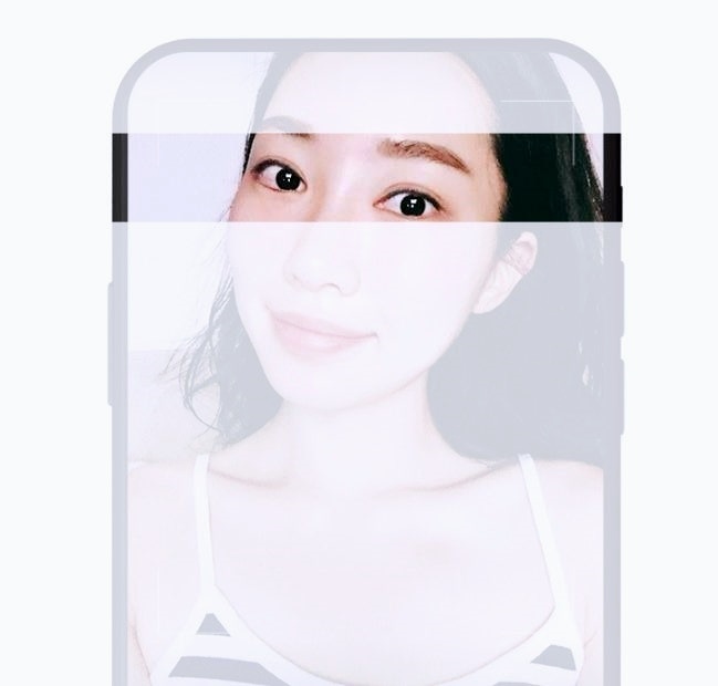 Mokdong Station Double Eyelid Surgery: Are the Surgical Methods Different for Protruding Eyes and Deep-Set Eyes? Don’t Regret Not Knowing image 4