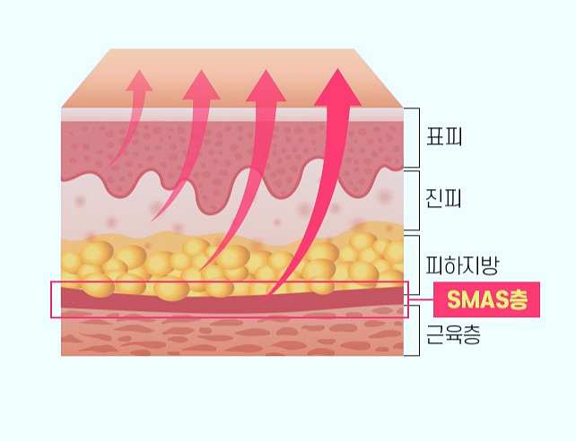 김포이마거상 흉터 걱정되시는 분들은 보세요 관련 이미지 2