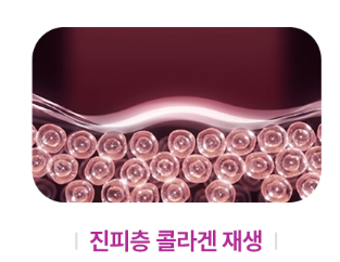 목동역 써마지 FLX, 탄력 리프팅에 효과 있을까? 관련 이미지 7