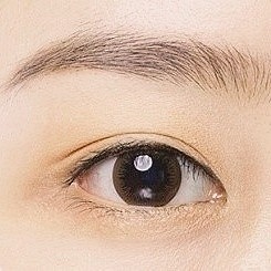 김포눈성형 나에게 어울리는 쌍꺼풀 라인 찾는 법(인라인vs아웃라인) 관련 이미지 4