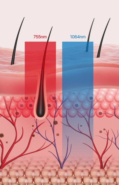 Mok-dong Laser Hair Removal: Worried About the Pain? image 4