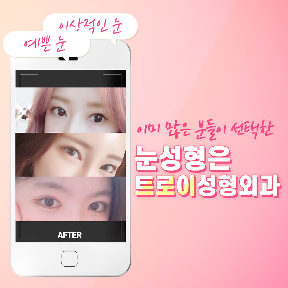 목동성형외과 잘하는 곳 찾고 계신 분들만 보세요 관련 이미지 2
