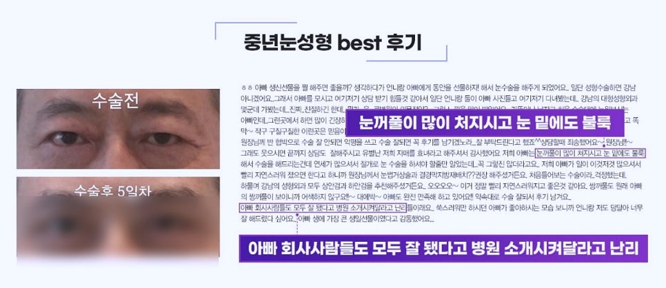 강서구성형외과 유명하다고 다 믿지 마세요 관련 이미지 3