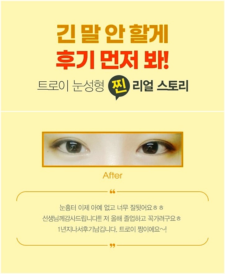오목교역성형외과 실패하지 않는 선택 방법 관련 이미지 3