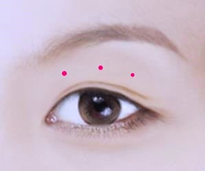 목동역눈매교정 흉터 걱정되면 ○○○로 하세요 관련 이미지 2