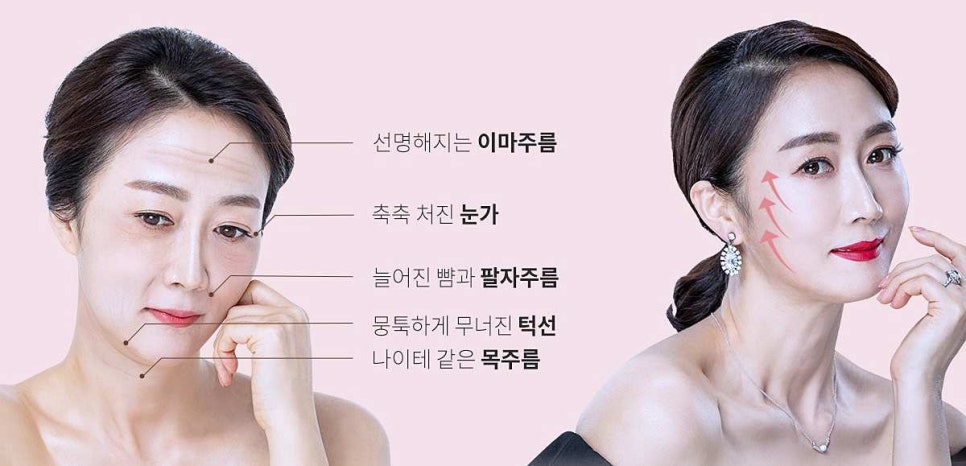 목동동안성형 어버이날 선물 추천 시/수술 3가지 관련 이미지 1