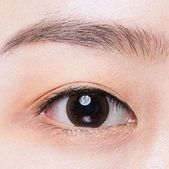 강서구눈성형 잘하는곳? 쌍수 부작용 예방 팁 관련 이미지 2