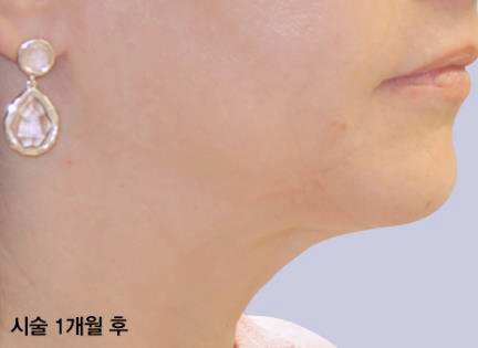 목동인모드 효과 관련 이미지 2