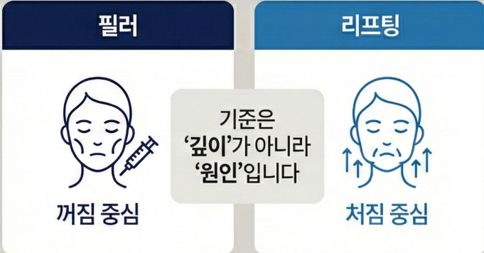 Mokdong Nasolabial Folds: What Is the Standard Between Fillers and Lifting? image 8