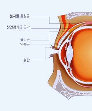 목동눈매교정 흉터걱정 된다면 비절개로 관련 이미지 1
