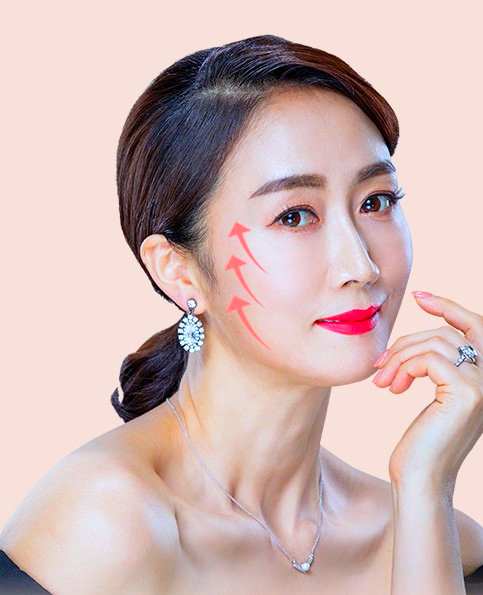 김포안면거상 흉터 관련 이미지 1
