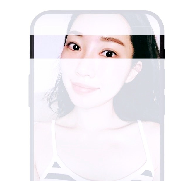 김포쌍수 매몰? 절개? 나에게 어울리는 수술법은? 관련 이미지 3