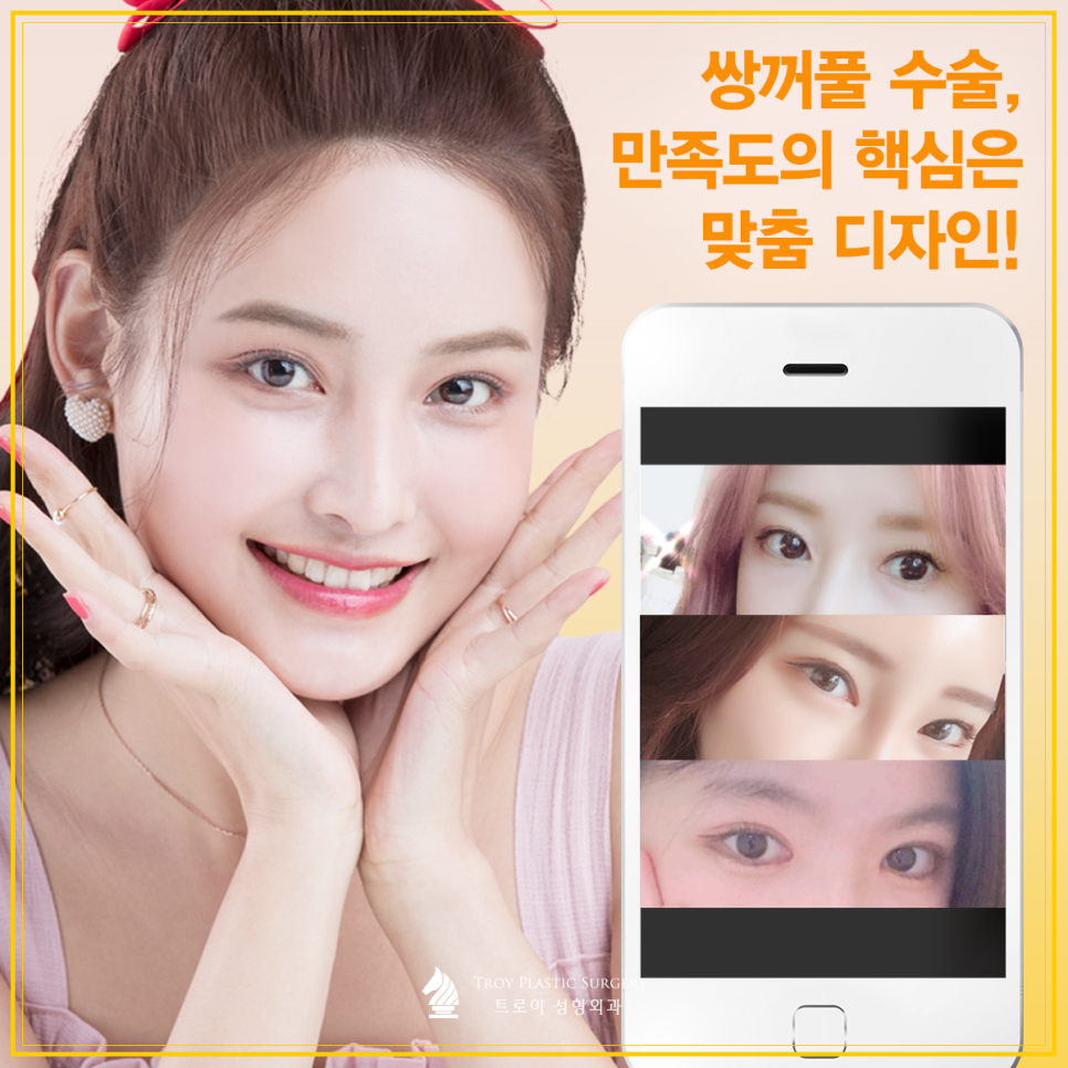 강서구눈성형 잘하는곳? 쌍수 부작용 예방 팁 관련 이미지 1