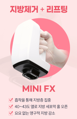 목동인모드 모르면 후회하는 이것 2가지 관련 이미지 4