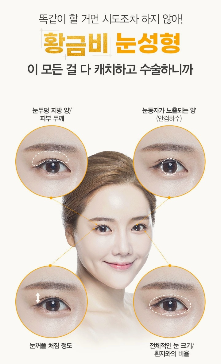 Recommended Types of Mokdong Middle-Aged Eye Surgery: 3 Surgery Options for Drooping Eyes image 4