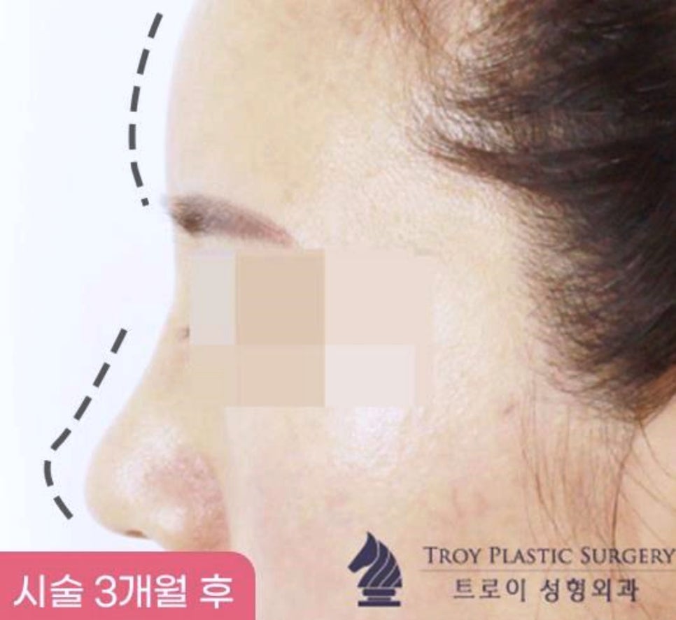 목동역성형외과 잘 고르는 핵심 알려드립니다 관련 이미지 3