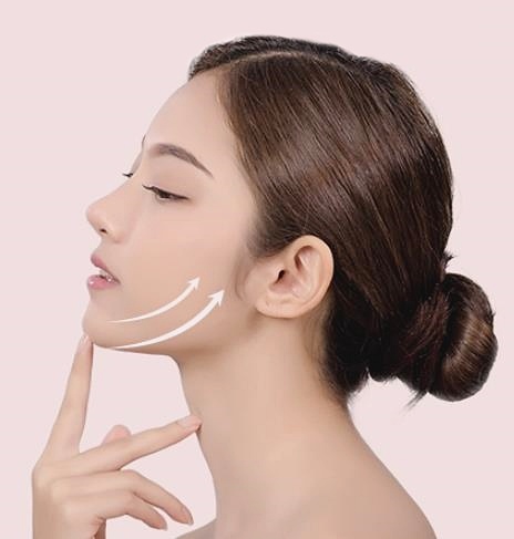 목동안면거상술 관련 이미지 2
