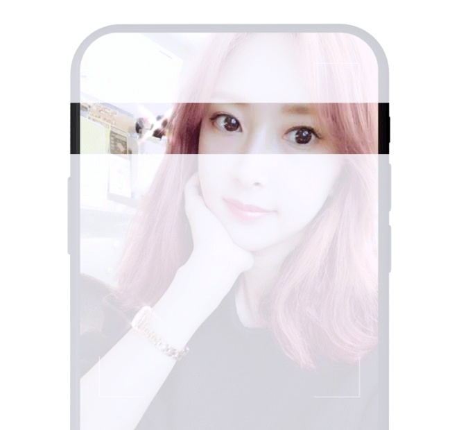 김포쌍수 매몰? 절개? 나에게 어울리는 수술법은? 관련 이미지 2