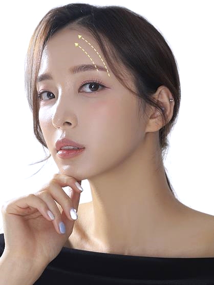 목동역이마거상 부작용? 흉터? 이걸로 종결합니다 관련 이미지 5