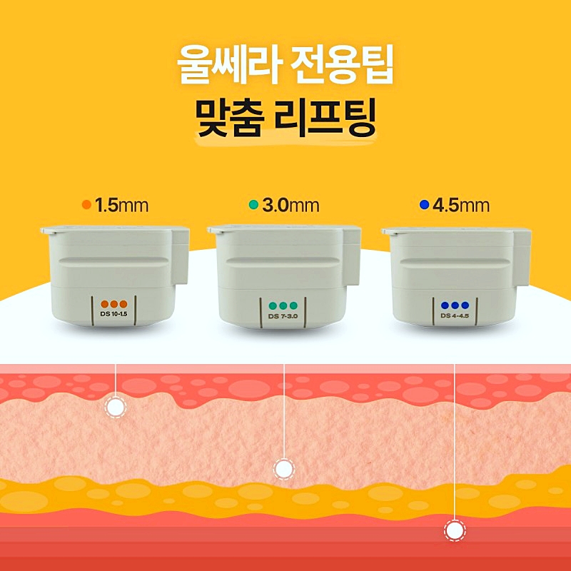 목동역피부과 울쎄라 레이저리프팅 샷수 추천해 주세요 관련 이미지 3