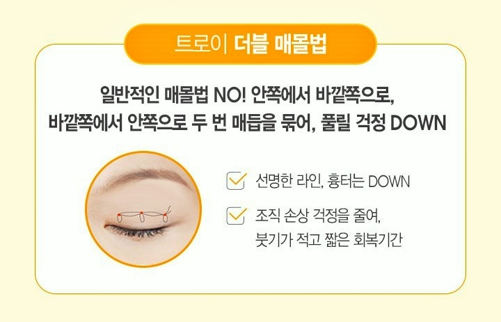 양천구눈성형 쌍꺼풀 매몰 vs 절개 뭐가 더 좋나요? 관련 이미지 1