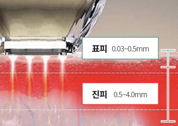 영등포포텐자 20대피부관리 추천 관련 이미지 4