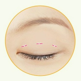 강서구쌍수 잘하는 곳 찾고 계시다면 보세요 관련 이미지 7